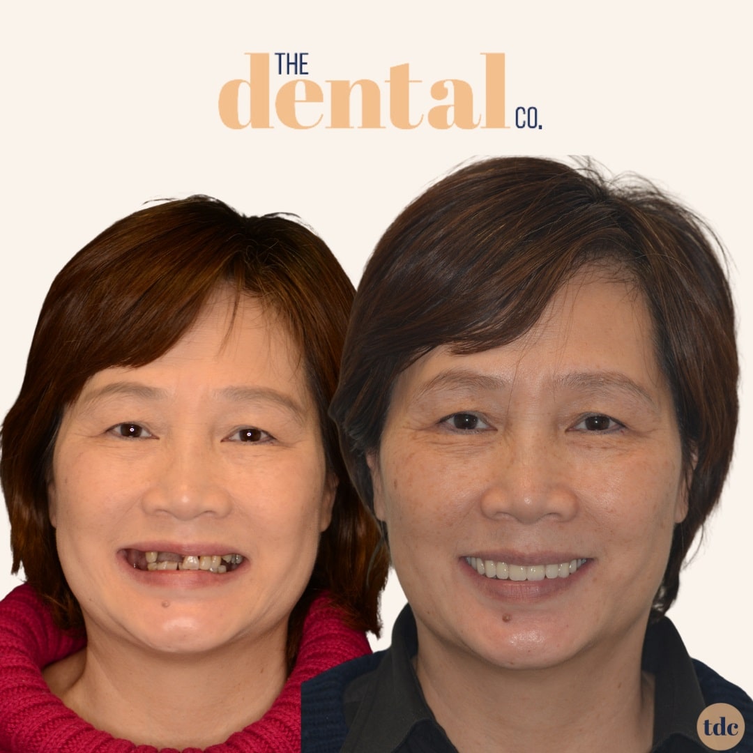 Before and After face_3-min