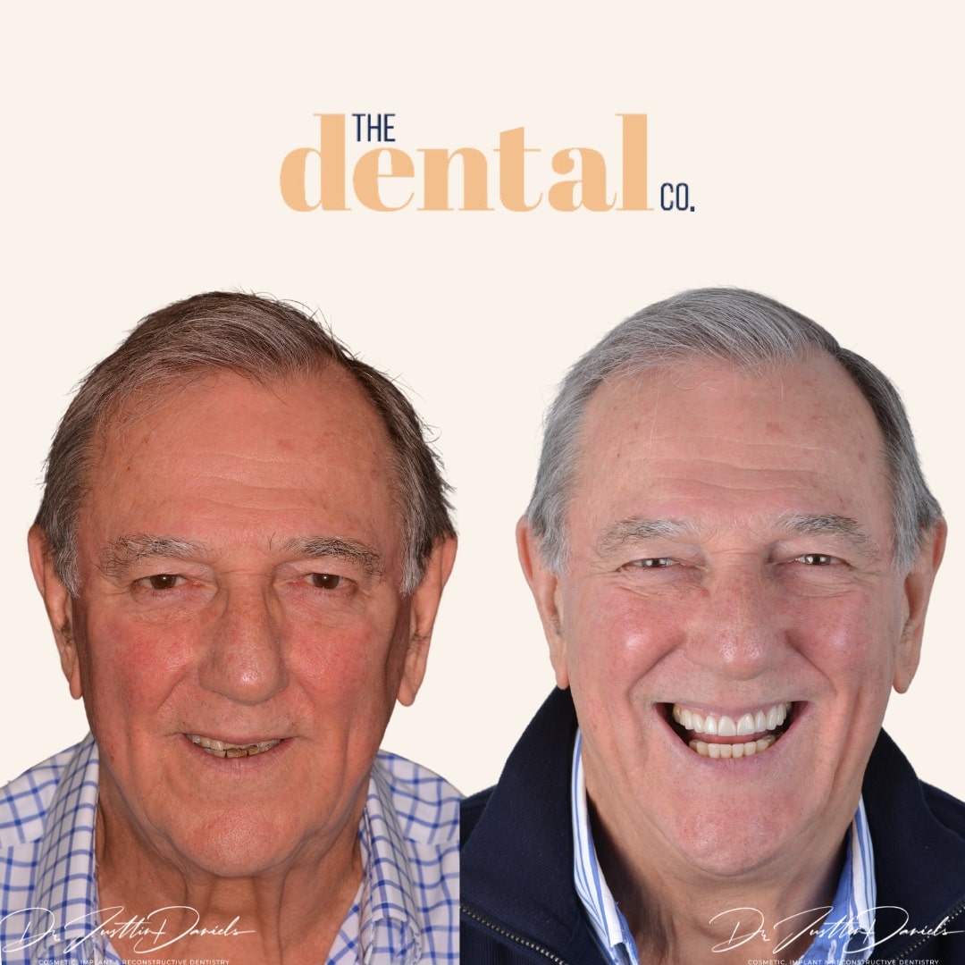 Before_and_After_face_1-min