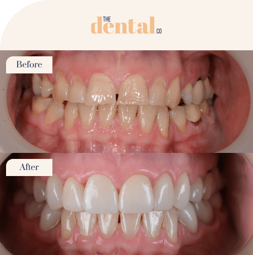 before-and-after-1-min